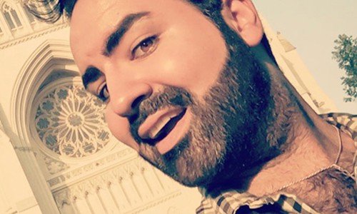 Sari_Before client before beardscaping with excess hair on neck